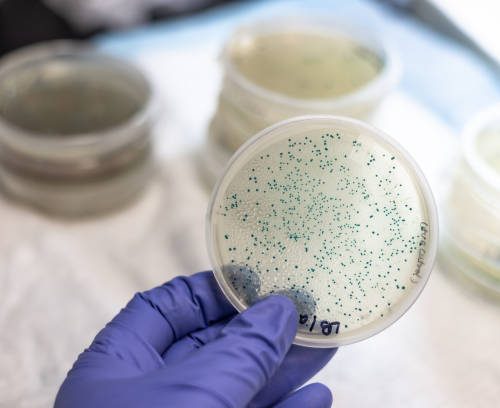 Microbial Whole Genome Sequencing (Bacteria < 7MB)